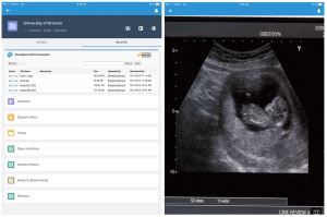 CloudpondS3Connector-For-Salesforce1